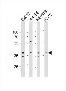 PRKAB1 Antibody