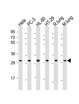 RPS4X Antibody (C-Term)