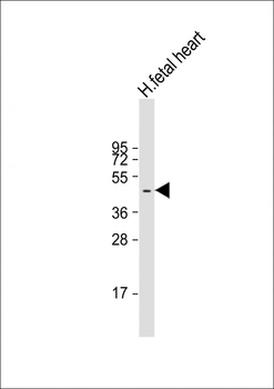 ZDHHC18 Antibody (C-Term)