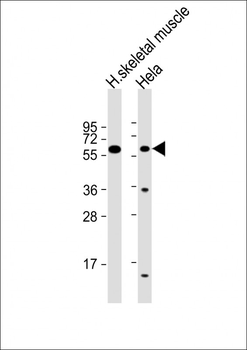 SLC29A2 Antibody (N-Term)