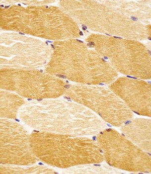 SLC29A2 Antibody (N-Term)