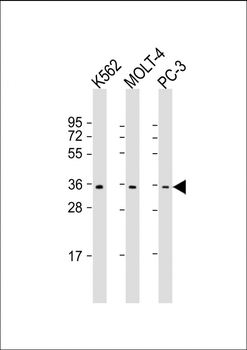 PIGC Antibody (C-Term)
