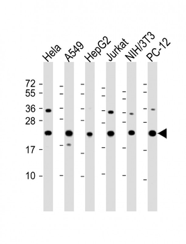RPS7 Antibody (C-Term)