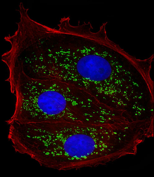 TFF1 Antibody (Center)