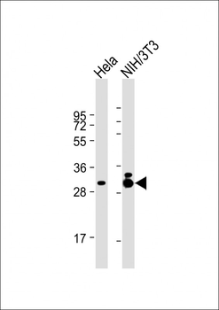 TPM3 Antibody
