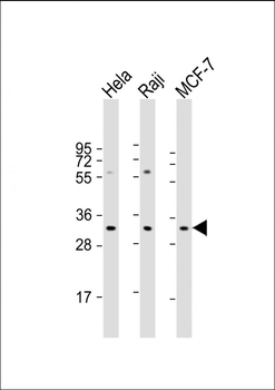 APIP Antibody (Center)
