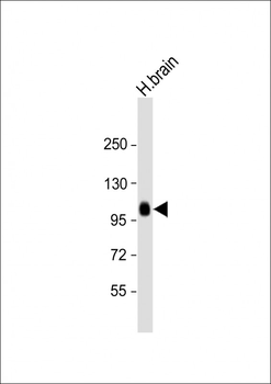 ADAMTS17 Antibody (N-term)