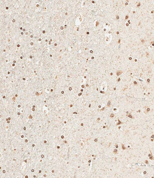 NUP93 Antibody (N-Term)