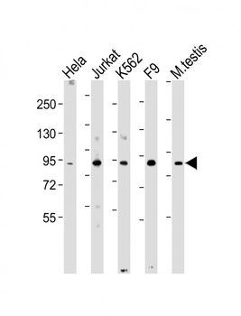 NUP93 Antibody (N-Term)