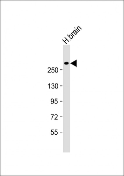 JMJD1C Antibody (C-Term)