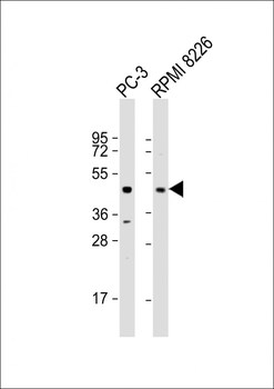 ACP6 Antibody (Center)