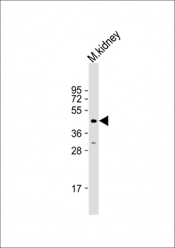 ACP6 Antibody (N-Term)