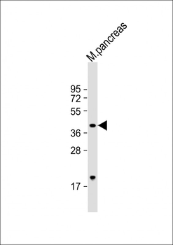 GMPPB Antibody (Center)