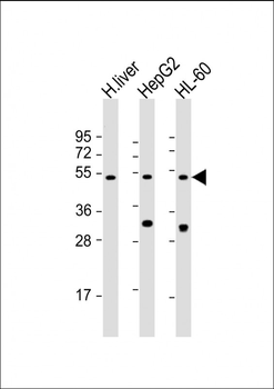 BAAT Antibody (N-Term)