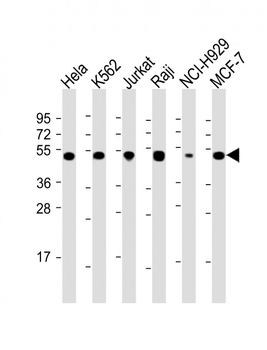 RPL4 Antibody (N-Term)