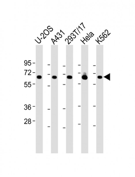 RSL1D1 Antibody (C-Term)