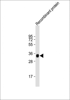 LRP1B Antibody