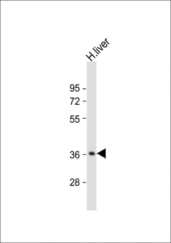 CTBS Antibody (N-Term)
