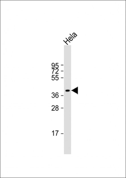 LPGAT1 Antibody (Center)