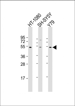 ZNF513 Antibody (N-Term)