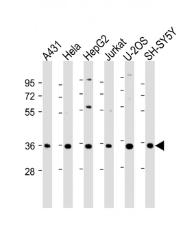 NT5C3 Antibody (C-Term)