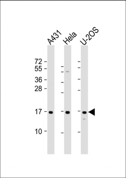 RPLP1 Antibody (N-Term)