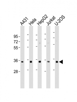 RNPS1 Antibody (N-Term)
