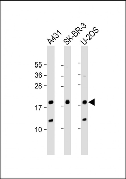 THRSP Antibody (N-Term)