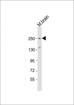 SPTBN1 Antibody (C-Term)