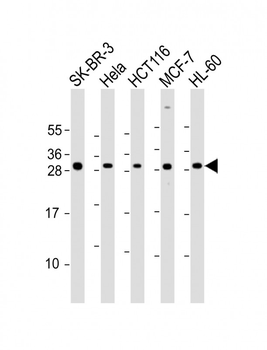 NAA10 Antibody (Center)