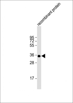 BRCA2 Antibody
