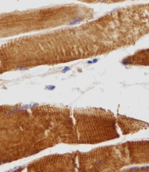 TTN Antibody (N-term)