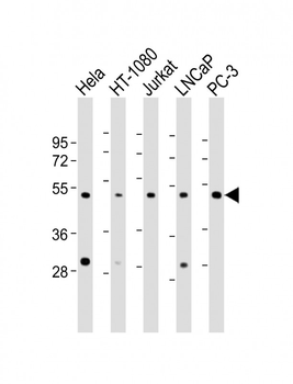 CERS4 Antibody (N-Term)