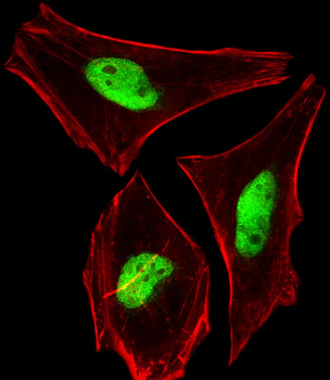 PHF6 Antibody (C-Term)