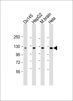 DAB2IP Antibody