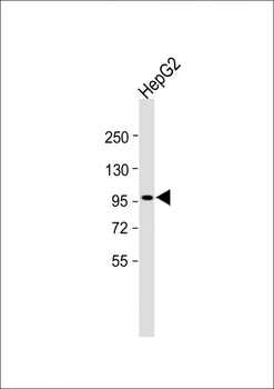 INTS6 Antibody (N-Term)