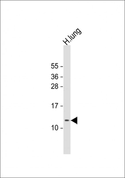RIG Antibody (C-Term)