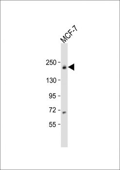 USP32 Antibody (N-Term)
