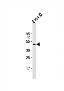 DEDD2 Antibody (N-Term)