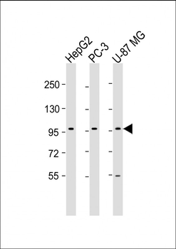 PCDH10 Antibody (N-Term)