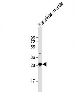 DNASE1L2 Antibody (C-Term)