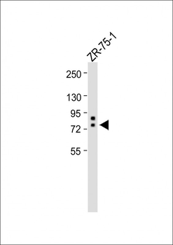 ERVK-9 Antibody (C-Term)