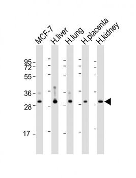 WBP1 Antibody (C-Term)
