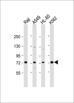 SKI Antibody (N-Term)