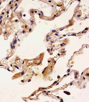 S100A2 Antibody
