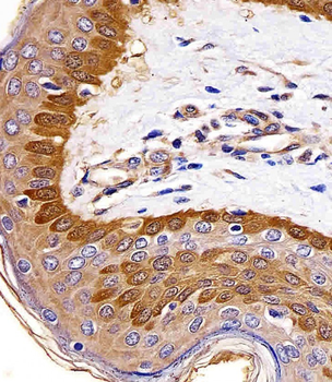 S100A2 Antibody