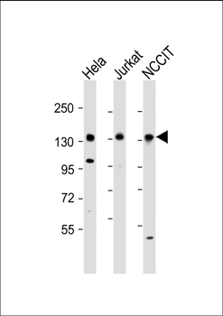 PHC1 Antibody (N-Term)