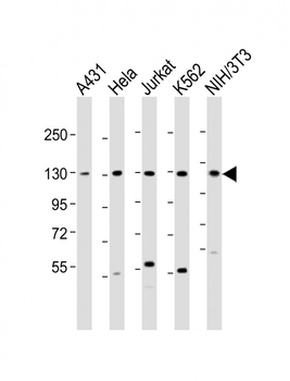 DDX42 Antibody (N-Term)
