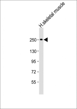 MYH4 Antibody (N-Term)