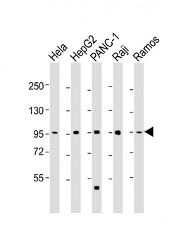 NUGGC Antibody (Center)